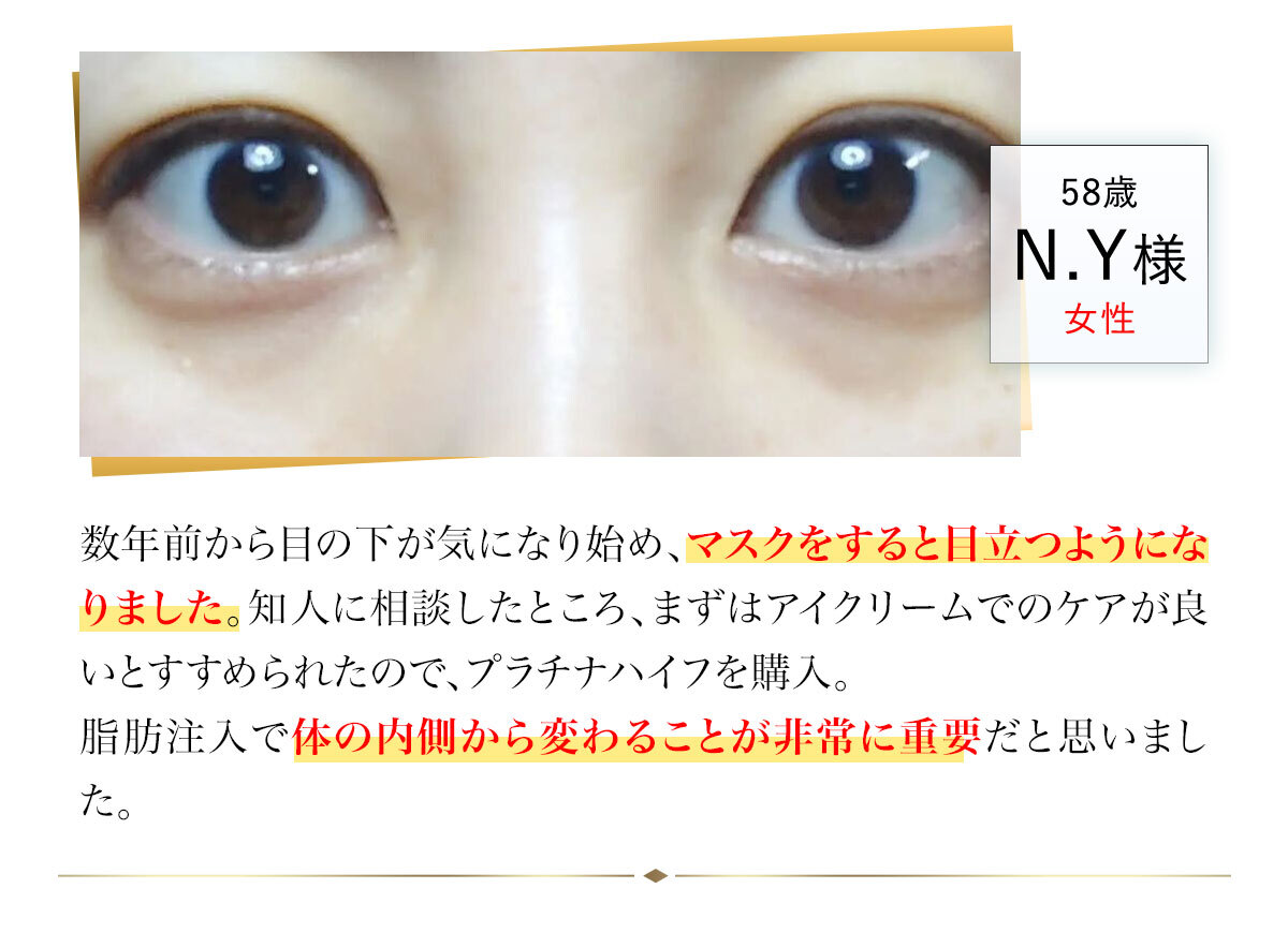 プラチナハイフ